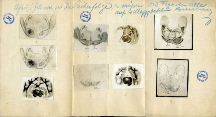 Illustrazioni per Besta, "Ueber die zerebro-zerebellaren Bahnen. Experimentelle Untersuchungen", 1912 (Archivio dell’Istituto Besta, inv. BST_219_01)