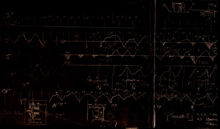 Tracciato respiratorio